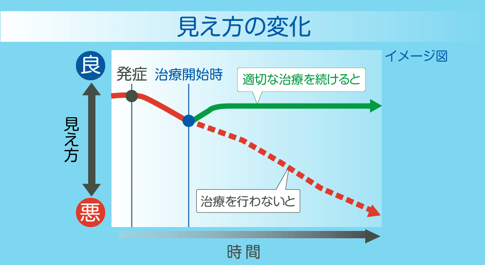 見え方の変化